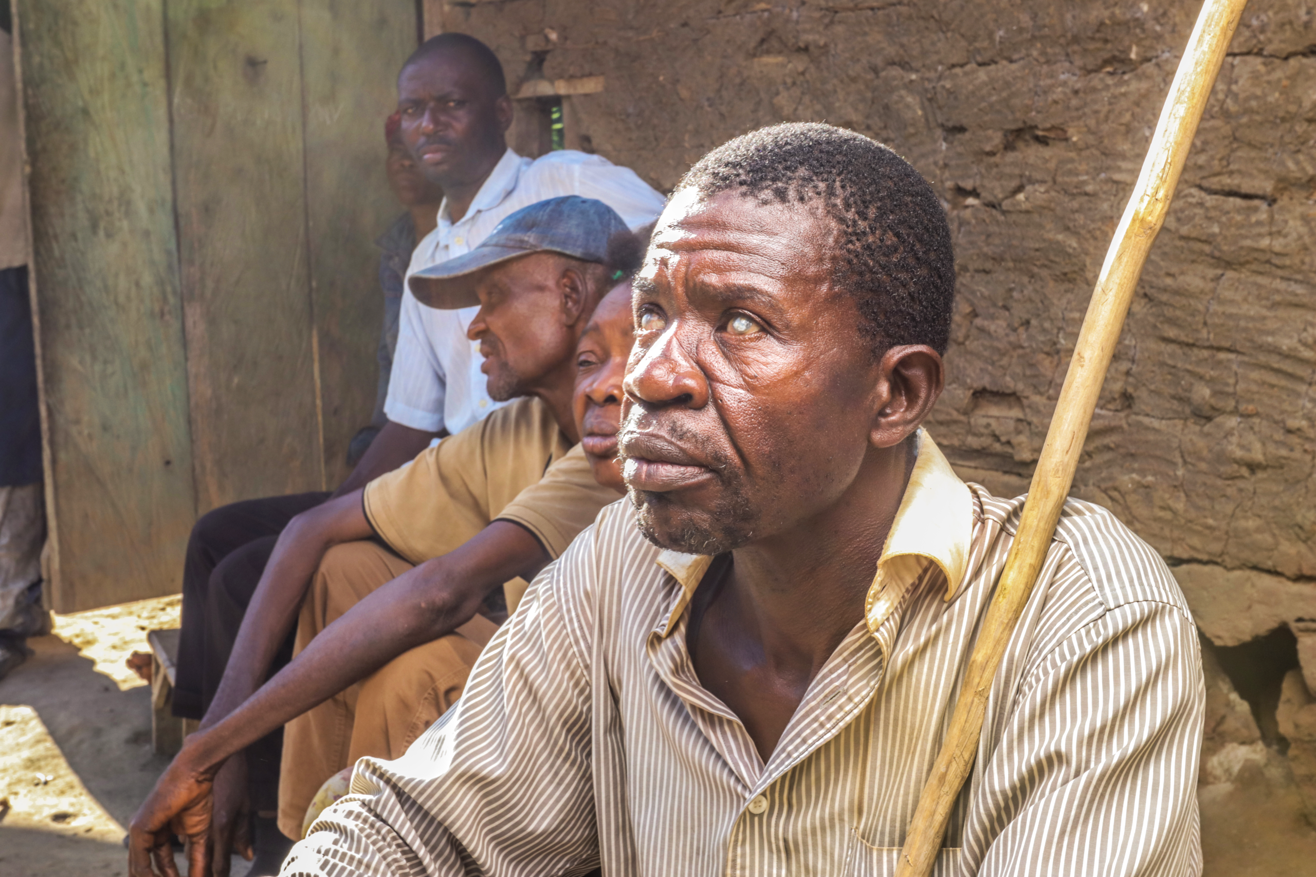 A man with onchocerciasis awaiting treatment distribution in 2018.