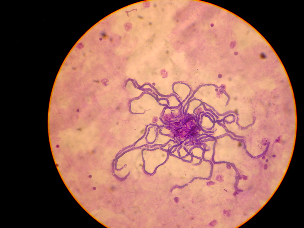 Loa loa worm under a microscope