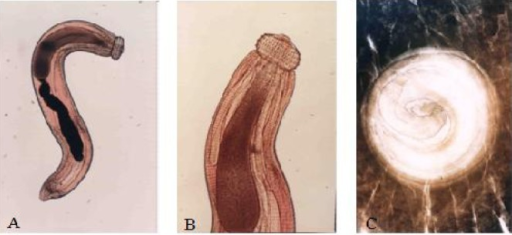 Microscopic image showing different views of Gnathostoma spinigerum larvae including whole larva, head bulb close-up, and encysted form