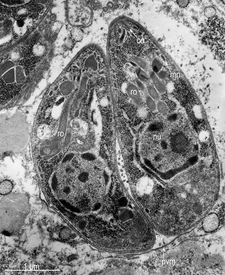 TEM image of two Toxoplasma gondii tachyzoites in a bar-shouldered dove lung