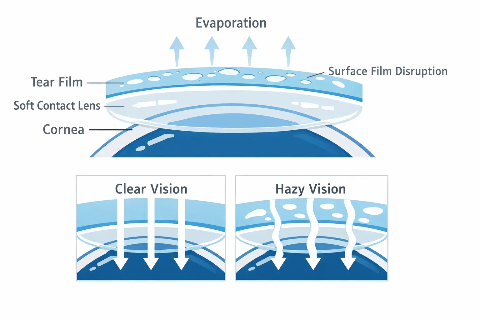 Tear Film and Lens Surface Explainer Diagram